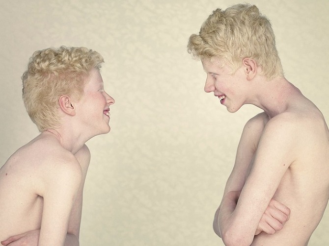 Albinos Project by Gustavo Lacerda in THISISPAPER MAGAZINE italo%20and%20renan Albinos Project by Gustavo Lacerda in THISISPAPER MAGAZINE