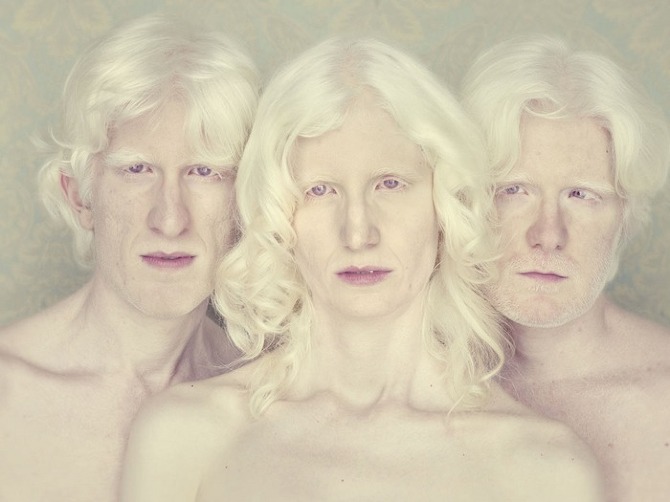 Albinos Project by Gustavo Lacerda in THISISPAPER MAGAZINE marcus%20andreza%20and%20andre Albinos Project by Gustavo Lacerda in THISISPAPER MAGAZINE