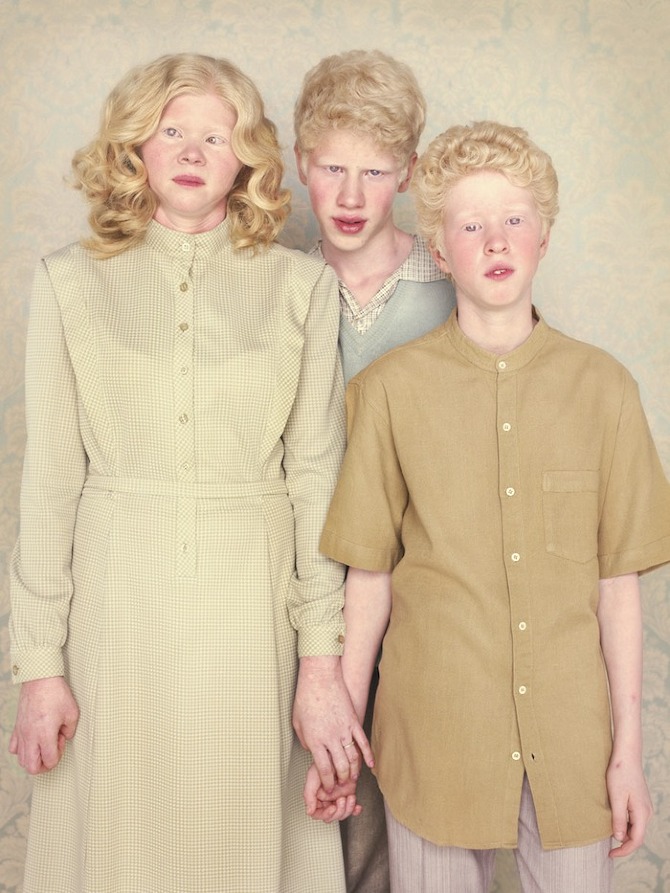 Albinos Project by Gustavo Lacerda in THISISPAPER MAGAZINE oleneide%20italo%20and%20renan Albinos Project by Gustavo Lacerda in THISISPAPER MAGAZINE